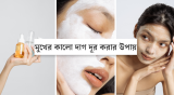 মুখের কালো দাগ দূর করার উপায় ও টিপস 2026