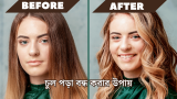 চুল পড়া বন্ধ করার উপায় ও ঔষধ 2026