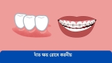 দাঁত ক্ষয় রোধ করার কার্যকরী উপায় 2026
