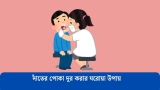 দাঁতের পোকা দূর করার ঘরোয়া উপায় 2026