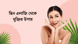 স্কিন এলার্জি থেকে মুক্তির উপায় ও ঔষধ 2026
